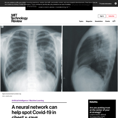 A neural network can help spot Covid-19 in chest x-rays - MIT Technology Review