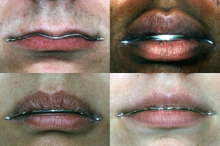 Anika Smulovitz Lip Liners 2003